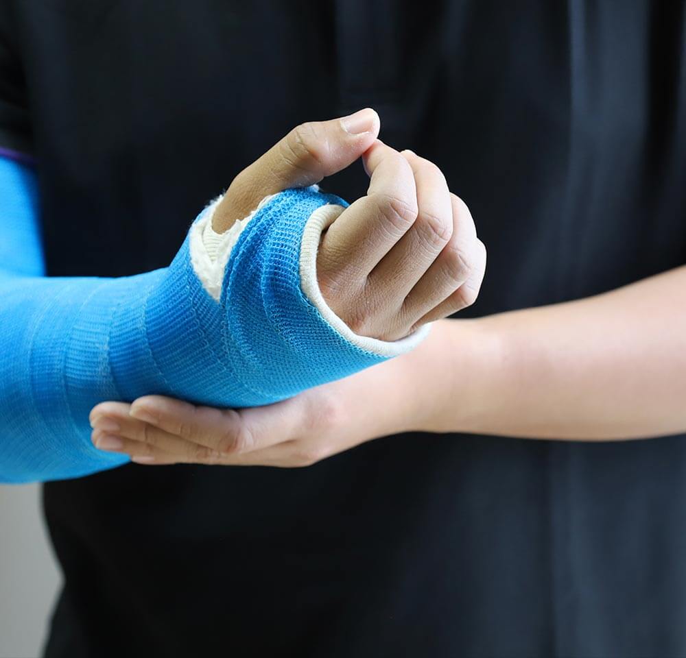 hand arm and wrist cast