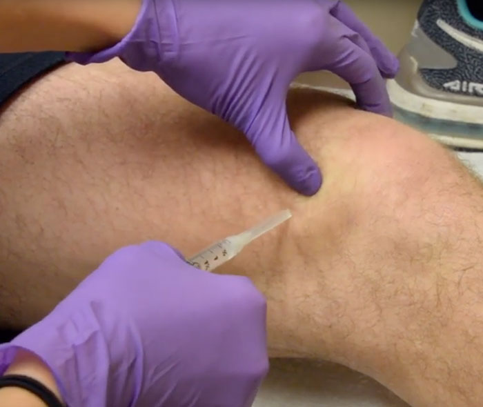 how orthobiologic injections work